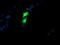 Golgi Membrane Protein 1 antibody, NBP2-01639, Novus Biologicals, Immunocytochemistry image 
