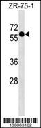 Zinc Finger Protein 503 antibody, 59-484, ProSci, Western Blot image 