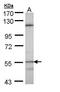 Cytochrome P450 Family 4 Subfamily B Member 1 antibody, PA5-28925, Invitrogen Antibodies, Western Blot image 