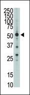 HtrA Serine Peptidase 1 antibody, PA5-11412, Invitrogen Antibodies, Western Blot image 