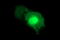 Mucosal Vascular Addressin Cell Adhesion Molecule 1 antibody, LS-C797763, Lifespan Biosciences, Immunofluorescence image 