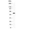 Tissue Factor Pathway Inhibitor antibody, R30896, NSJ Bioreagents, Western Blot image 