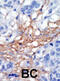 Phosphatidylinositol-4-Phosphate 5-Kinase Type 1 Gamma antibody, abx033838, Abbexa, Western Blot image 
