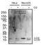 Microtubule Associated Protein 1 Light Chain 3 Alpha antibody, NBP2-75924, Novus Biologicals, Western Blot image 