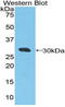DExD/H-Box Helicase 58 antibody, LS-C296227, Lifespan Biosciences, Western Blot image 