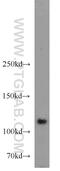 Hepatocyte Growth Factor-Regulated Tyrosine Kinase Substrate antibody, 10390-1-AP, Proteintech Group, Western Blot image 