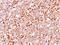 CD79a antibody, GTX34562, GeneTex, Immunohistochemistry paraffin image 