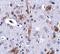 Tau Tubulin Kinase 1 antibody, NBP1-76989, Novus Biologicals, Immunohistochemistry paraffin image 