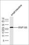 Ring Finger Protein 186 antibody, orb1617, Biorbyt, Western Blot image 