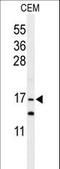 Glia Maturation Factor Gamma antibody, LS-C166534, Lifespan Biosciences, Western Blot image 
