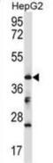 Branched Chain Keto Acid Dehydrogenase Kinase antibody, abx027612, Abbexa, Western Blot image 