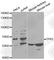Tumor Protein P63 antibody, A2137, ABclonal Technology, Western Blot image 