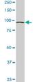 VPS18 Core Subunit Of CORVET And HOPS Complexes antibody, H00057617-M01, Novus Biologicals, Western Blot image 