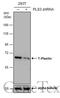 Plastin 3 antibody, GTX632482, GeneTex, Western Blot image 