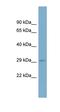 RAB23, Member RAS Oncogene Family antibody, orb330899, Biorbyt, Western Blot image 