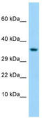 Taste 1 Receptor Member 1 antibody, TA337751, Origene, Western Blot image 