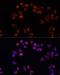 Solute Carrier Family 25 Member 4 antibody, LS-C749998, Lifespan Biosciences, Immunofluorescence image 