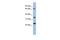 TBC1 Domain Family Member 25 antibody, GTX45062, GeneTex, Western Blot image 