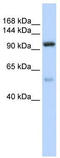 Nucleolar Protein 6 antibody, TA343920, Origene, Western Blot image 