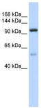 Nucleolar Protein 6 antibody, TA343920, Origene, Western Blot image 