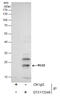 Regulator Of G Protein Signaling 2 antibody, GTX113349, GeneTex, Immunoprecipitation image 