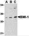 BMI1 Proto-Oncogene, Polycomb Ring Finger antibody, 3755, ProSci, Western Blot image 