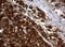 NME/NM23 Nucleoside Diphosphate Kinase 1 antibody, LS-C175579, Lifespan Biosciences, Immunohistochemistry frozen image 