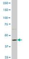 Protein Phosphatase 1 Regulatory Subunit 9A antibody, H00055607-M01, Novus Biologicals, Western Blot image 