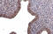 Plastin 3 antibody, GTX632481, GeneTex, Immunohistochemistry paraffin image 