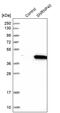 U5 small nuclear ribonucleoprotein 40 kDa protein antibody, PA5-55589, Invitrogen Antibodies, Western Blot image 