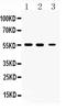 Tubulin Beta 3 Class III antibody, PA5-80198, Invitrogen Antibodies, Western Blot image 