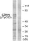 Ezrin antibody, LS-C117353, Lifespan Biosciences, Western Blot image 