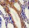 Stromal Interaction Molecule 1 antibody, LS-C161558, Lifespan Biosciences, Immunohistochemistry paraffin image 