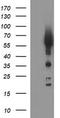 Tyrosine Hydroxylase antibody, TA506541AM, Origene, Western Blot image 