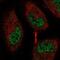 eEF-2 kinase antibody, NBP2-58790, Novus Biologicals, Immunofluorescence image 