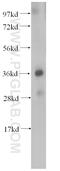 O-Sialoglycoprotein Endopeptidase antibody, 15033-1-AP, Proteintech Group, Western Blot image 