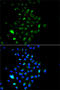Junction Plakoglobin antibody, 13-339, ProSci, Immunofluorescence image 