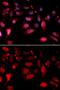 Rac GTPase Activating Protein 1 antibody, GTX32831, GeneTex, Immunofluorescence image 