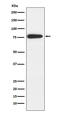 Microtubule Affinity Regulating Kinase 2 antibody, M02117-1, Boster Biological Technology, Western Blot image 