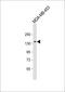 Glutamate Ionotropic Receptor NMDA Type Subunit 2A antibody, 55-818, ProSci, Western Blot image 