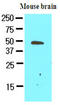 Growth Arrest Specific 7 antibody, AM09076PU-S, Origene, Western Blot image 