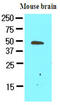 Growth Arrest Specific 7 antibody, AM09076PU-S, Origene, Western Blot image 