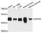Glycogen Synthase Kinase 3 Beta antibody, STJ27921, St John