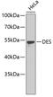 Desmin antibody, 13-828, ProSci, Western Blot image 