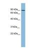 Protein Kinase C Beta antibody, NBP1-58914, Novus Biologicals, Western Blot image 