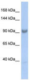 Spliceosome Associated Factor 3, U4/U6 Recycling Protein antibody, TA335613, Origene, Western Blot image 