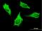 Myosin Heavy Chain 9 antibody, H00004627-M06, Novus Biologicals, Immunofluorescence image 