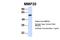 Matrix Metallopeptidase 20 antibody, PA5-42893, Invitrogen Antibodies, Western Blot image 