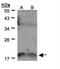 Interleukin 36 Gamma antibody, NBP1-31185, Novus Biologicals, Western Blot image 