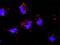 P21 (RAC1) Activated Kinase 2 antibody, H00005062-M01, Novus Biologicals, Proximity Ligation Assay image 